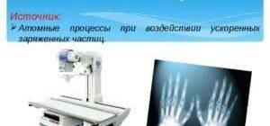 Рентгеновские снимки